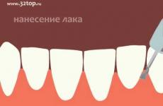 Embedded thumbnail for Фторирование зубов